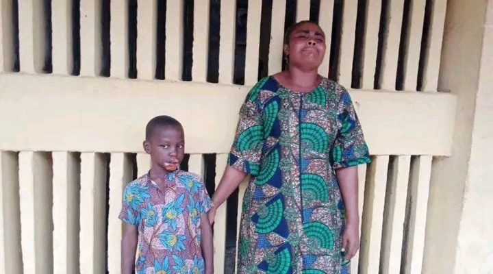 Taraba Woman Severely Injures Step-Grandson by Cutting His Lips with a Hot Knife (Photos)